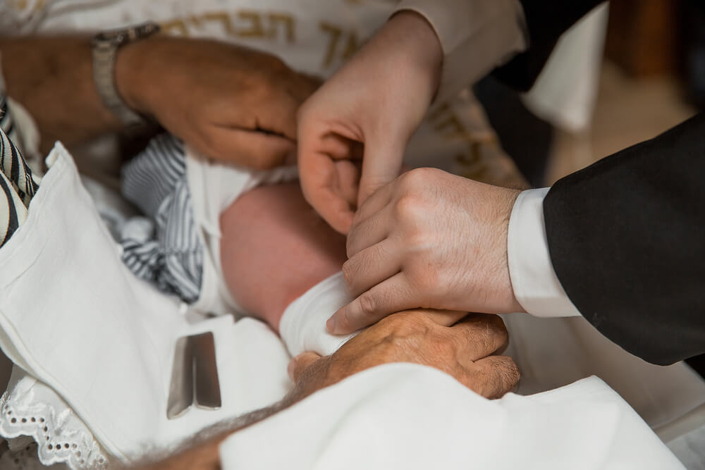 How to Prepare Your Baby for Circumcision? Feeding, Sleep, and Soothing Tips